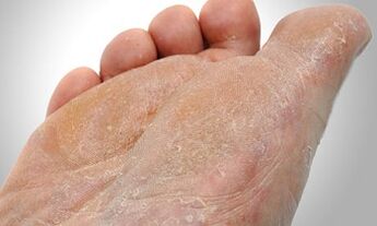 Poti prenosa gliv za noge